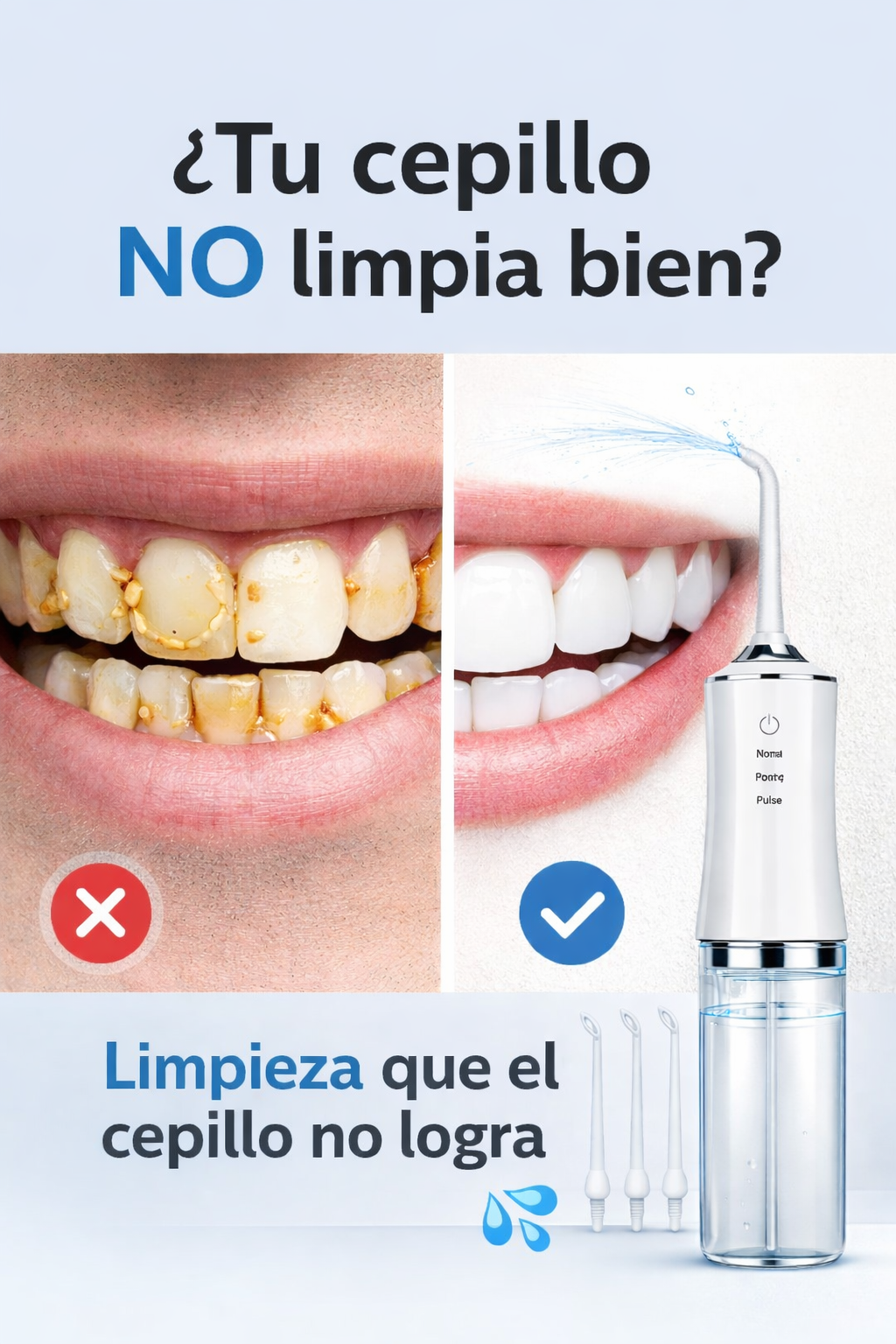 Irrigador Bucal Profesional | Elimina el mal aliento y limpia en profundidad desde el primer uso